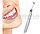 Средство для отбеливания зубов SONIC PIC Gentle at Home Dental Cleaning System, фото 9