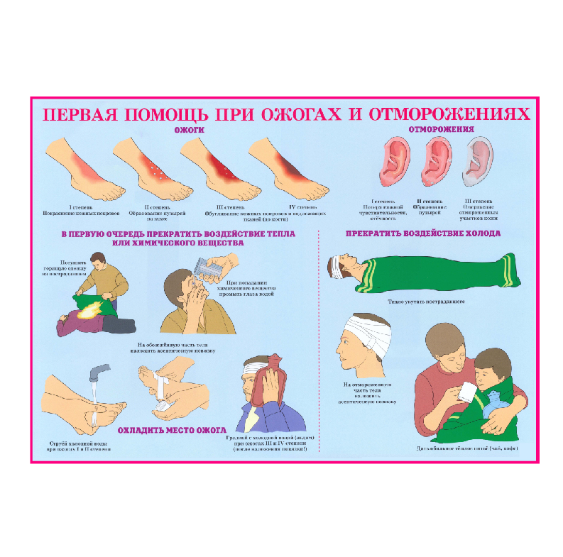 Информационный стенд "Первая помощь при ожогах и отморожениях" - фото 1 - id-p181694395