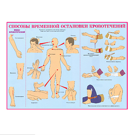 Информационный стенд "Cпособы временной остановки кровотечений"