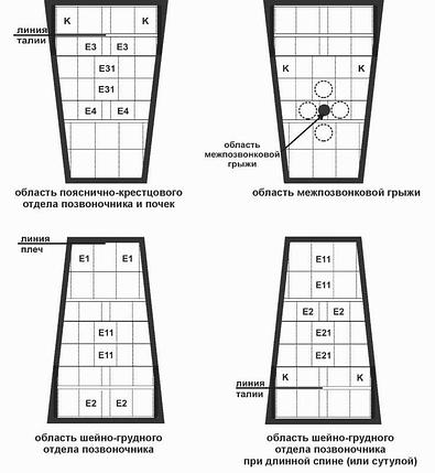 Манжета фиксирующая позвоночная, фото 2