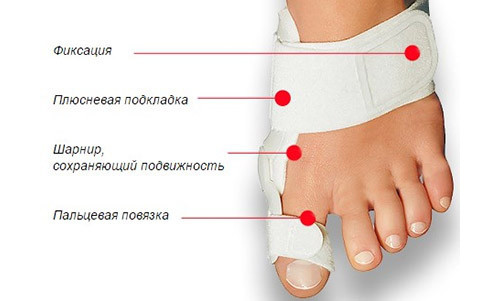 Шарнирная шина HALLUX VALGUS для коррекции большого пальца стопы - фото 9 - id-p185067496