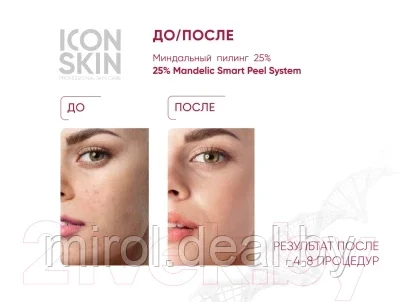 Пилинг для лица Icon Skin 25% Mandelic Smart Peel System - фото 5 - id-p185401408