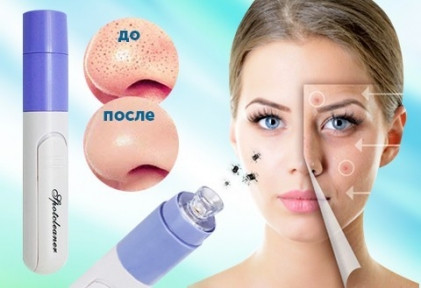 Вакуумный очиститель пор Pore Cleaner A suit for cleaning skin