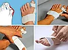 Ортопедический корсет от косточки на ноге Hallufix Hallux Valgus Schiene, фото 5