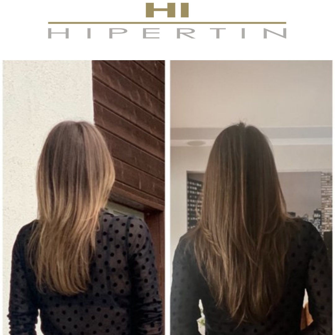 Набор Hipertin Linecure против выпадения волос - фото 3 - id-p195559790