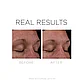 Сыворотка с 0,5% ретинолом обновляющая Cosmedix Serum16 Rapid Renewal Serum 30мл, фото 3