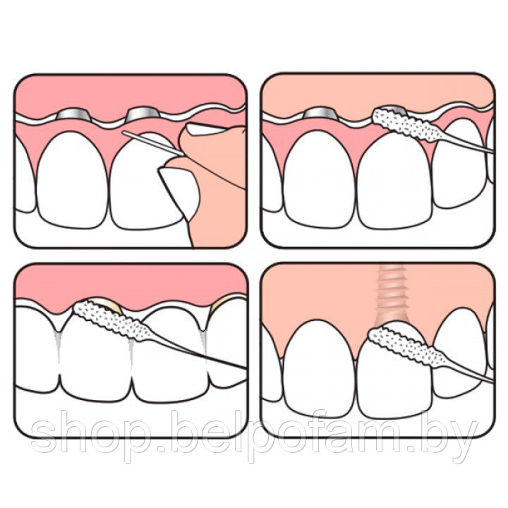 Зубная нить ТеРе Bridge & Implant Floss, уп. 30 шт - фото 2 - id-p199353656