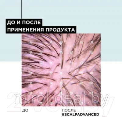 Шампунь для волос L'Oreal Professionnel Scalp Advanced регулирующий баланс чувствительной кожи головы - фото 7 - id-p200712206