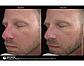 Крем акселератор для кожи с розацеа RosaLieve® Redness Reducing Complex Jan Marini, фото 4