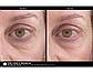 Сыворотка для век с ретинолом от темных кругов и морщин Marini Luminate® Eye Gel Jan Marini, фото 4