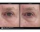 Сыворотка для век с ретинолом от темных кругов и морщин Marini Luminate® Eye Gel Jan Marini, фото 5