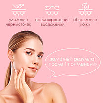 Вакуумный очиститель пор кожи Multifunctional Clening Instrument, фото 2
