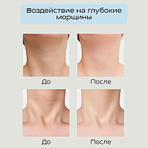 EMS Массажёр для лица и декольте микротоковый с RF-лифтинг эффектом Intense Pulsed Light ES-1081, фото 2