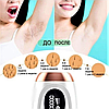 Фотоэпилятор для удаления волос IPL Hair Removal Device 999999 импульсов, фото 2