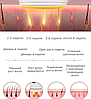Домашний лазерный фотоэпилятор Intence Pulsed Light AM001 Million (900 000 импульсов) + в подарок защитные очк, фото 6
