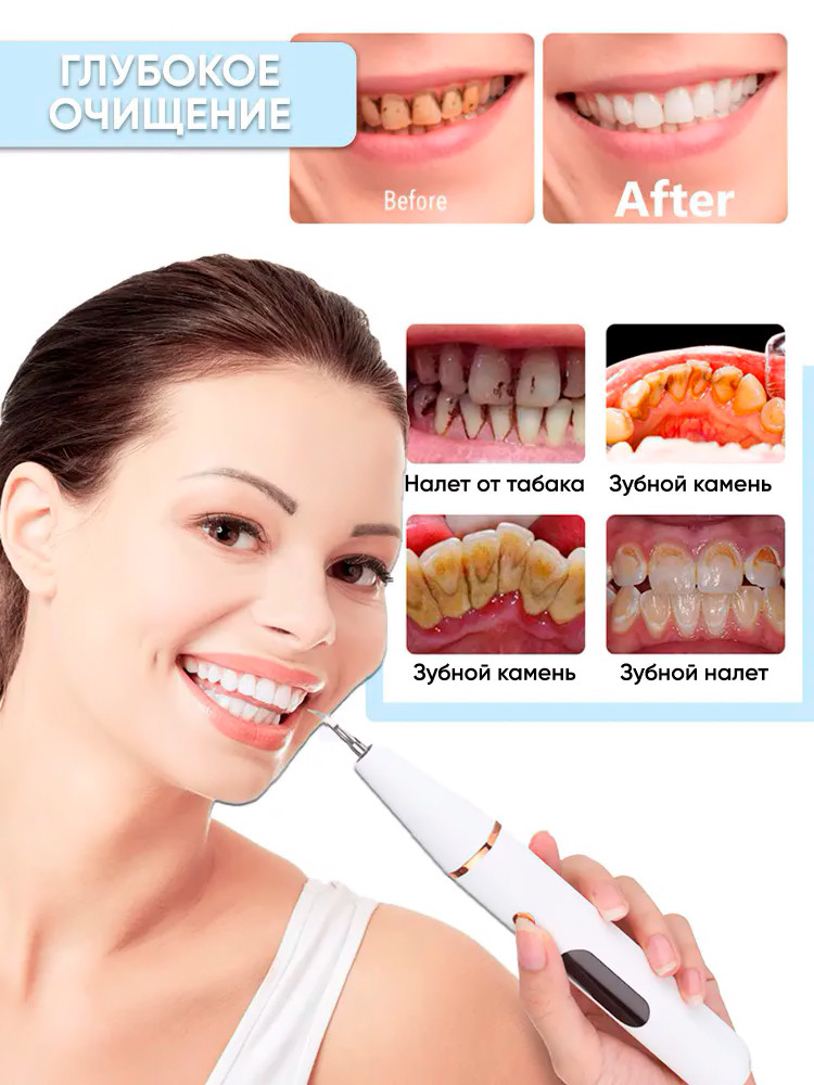 Электрический ультразвуковой скалер для чистки зубов с 2 сменными насадками Home-Use Dental Tools - фото 8 - id-p204381309