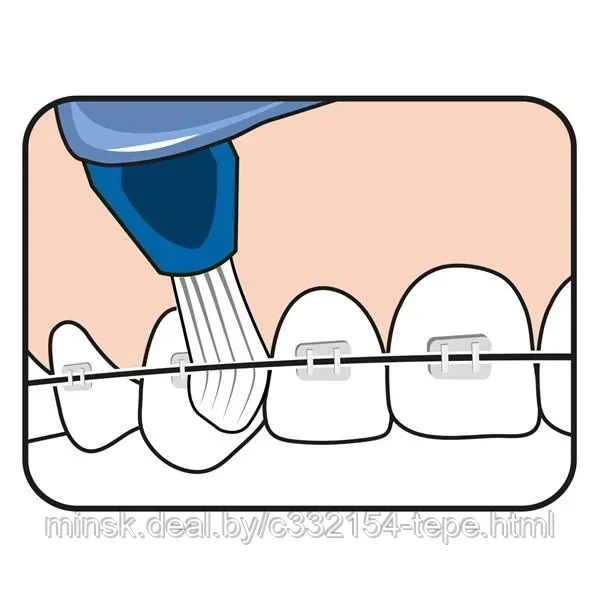 Зубная щетка ТеРе Interspace с мягким заостренным кончиком, 12 насадки с мягкой степенью жесткости. - фото 7 - id-p105457434
