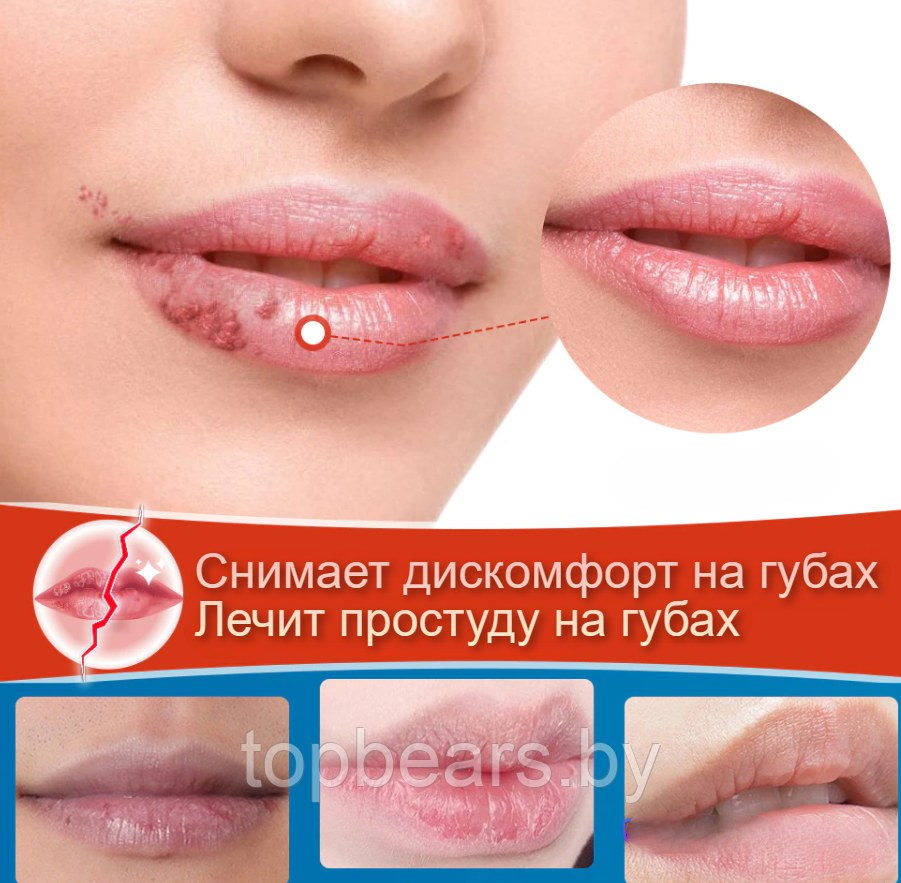 Восстанавливающий бальзам для губ Sumifun Cheilitis 20 гр. / Крем антибактериальный для лечения простуды - фото 2 - id-p207133057