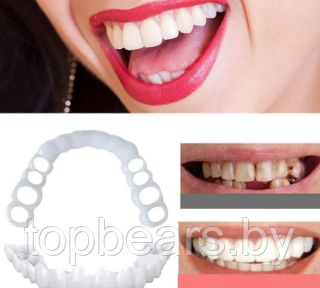 Накладные виниры для зубов Snap-On Smile / Съемные универсальные виниры для ослепительной улыбки 2 шт. (на две - фото 1 - id-p207133058