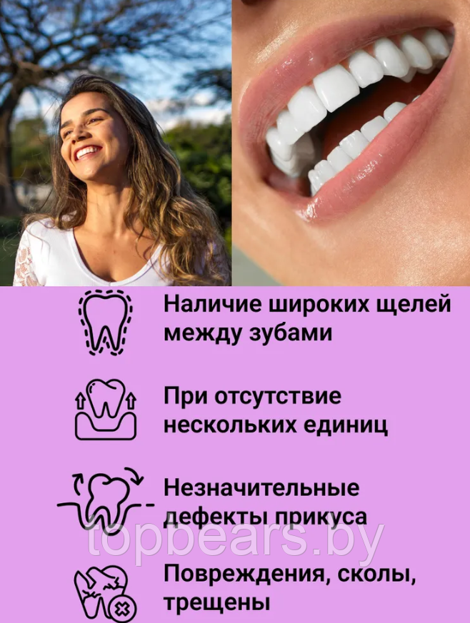 Накладные виниры для зубов Snap-On Smile / Съемные универсальные виниры для ослепительной улыбки 2 шт. (на две - фото 3 - id-p207133058