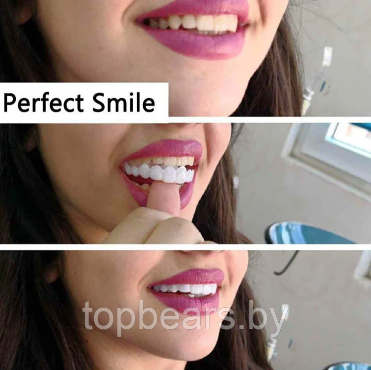 Накладные виниры для зубов Snap-On Smile / Съемные универсальные виниры для ослепительной улыбки 2 шт. (на две - фото 5 - id-p207133058