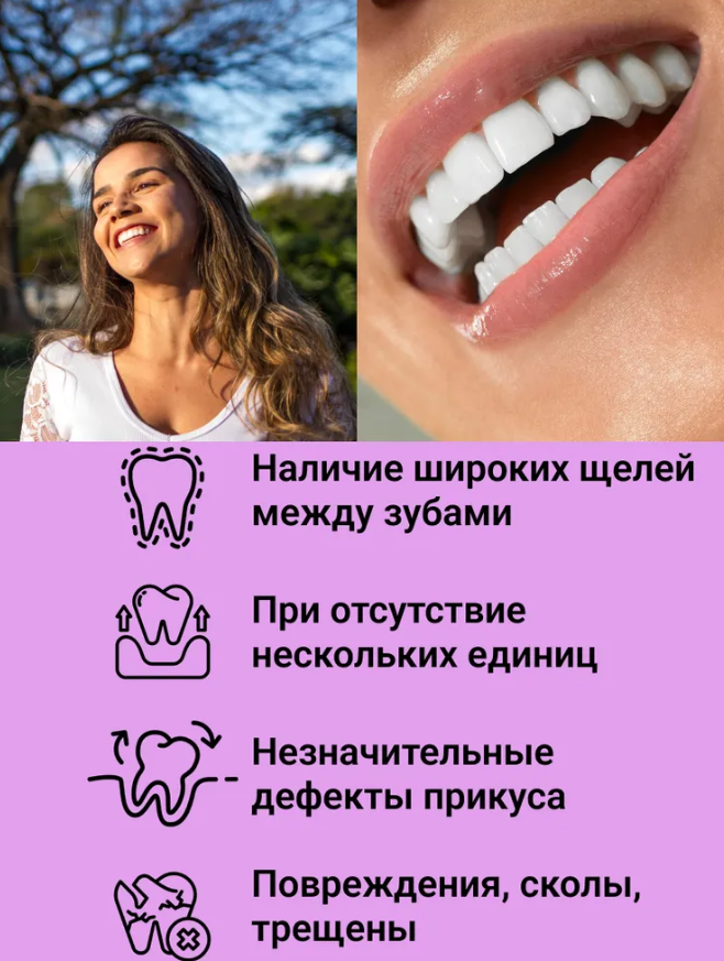 Накладные виниры для зубов Snap-On Smile / Съемные универсальные виниры для ослепительной улыбки 2 шт. (на две - фото 9 - id-p207134918