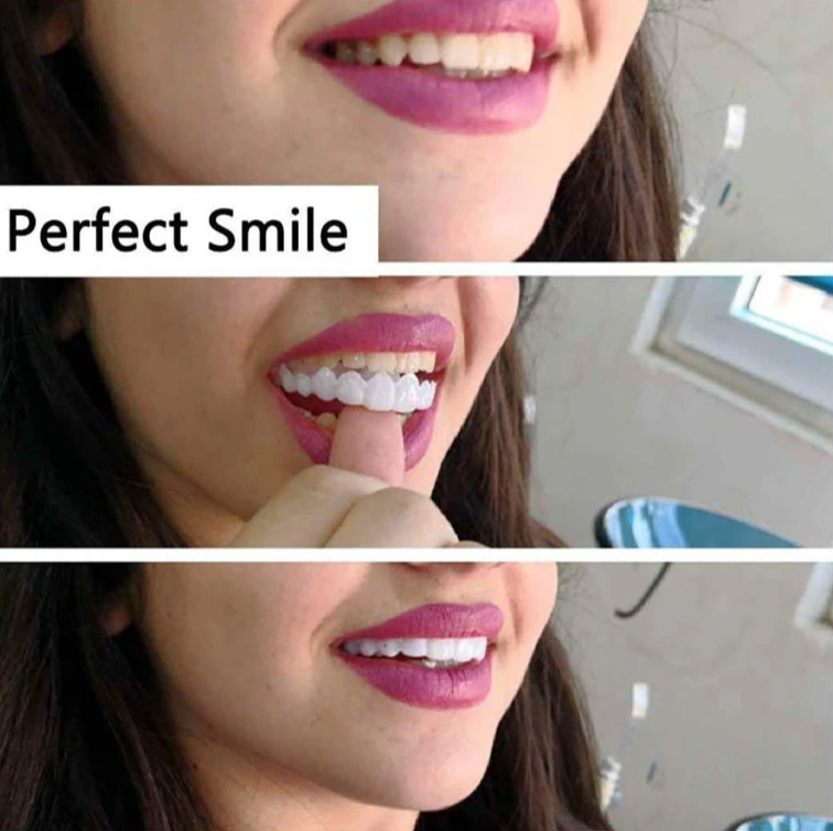 Накладные виниры для зубов Snap-On Smile / Съемные универсальные виниры для ослепительной улыбки 2 шт. (на две - фото 10 - id-p207134918