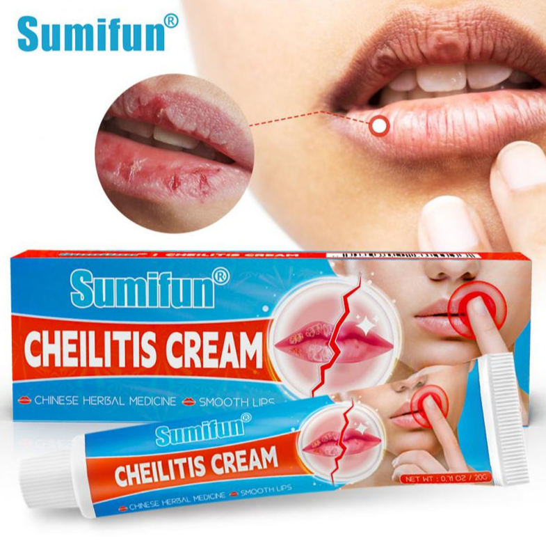 Восстанавливающий бальзам для губ Sumifun Cheilitis 20 гр. / Крем антибактериальный для лечения простуды - фото 5 - id-p207134999
