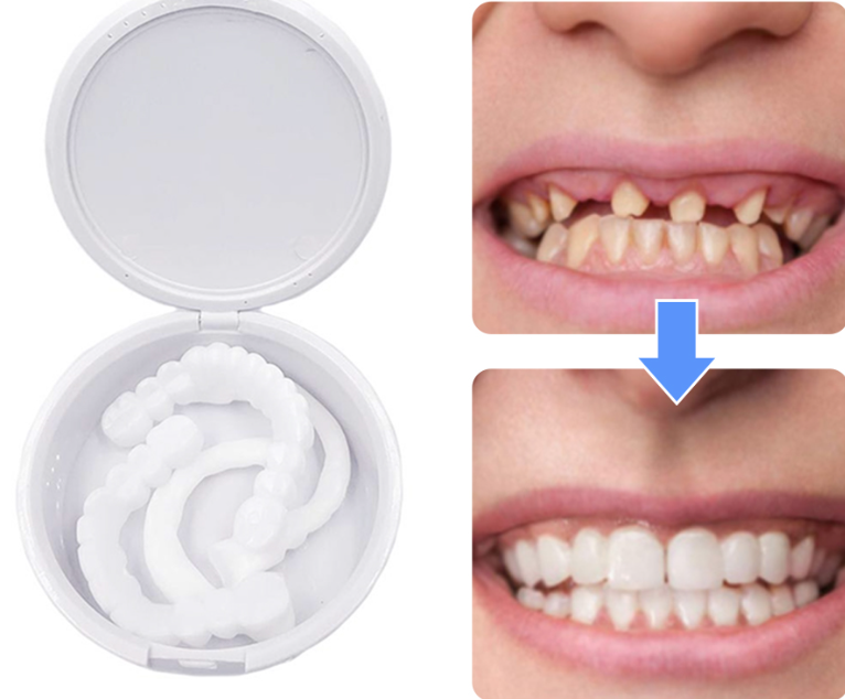 Накладные виниры для зубов Snap-On Smile / Съемные универсальные виниры для ослепительной улыбки 2 шт. (на две - фото 9 - id-p207135000