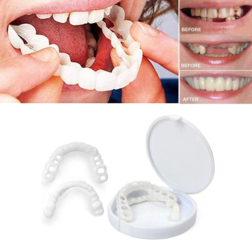 Накладные виниры для зубов Snap-On Smile / Съемные универсальные виниры для ослепительной улыбки 2 шт. (на две - фото 6 - id-p207135000