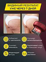 Антицеллюлитный вакуумный массажер банка Intelligent Breathing Cupping Massage Instrument, фото 2