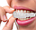 Накладные виниры для зубов Snap-On Smile / Съемные универсальные виниры для ослепительной улыбки 1 шт., фото 9