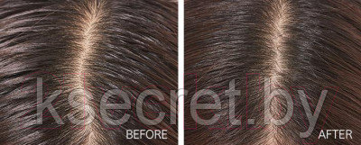 Укрепляющий шампунь для волос MISSHA Scalp Therapy Shampoo - 400ml - фото 4 - id-p209646777