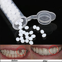 Клей для виниров (временного восстановления зубов)   (~3 гр.)