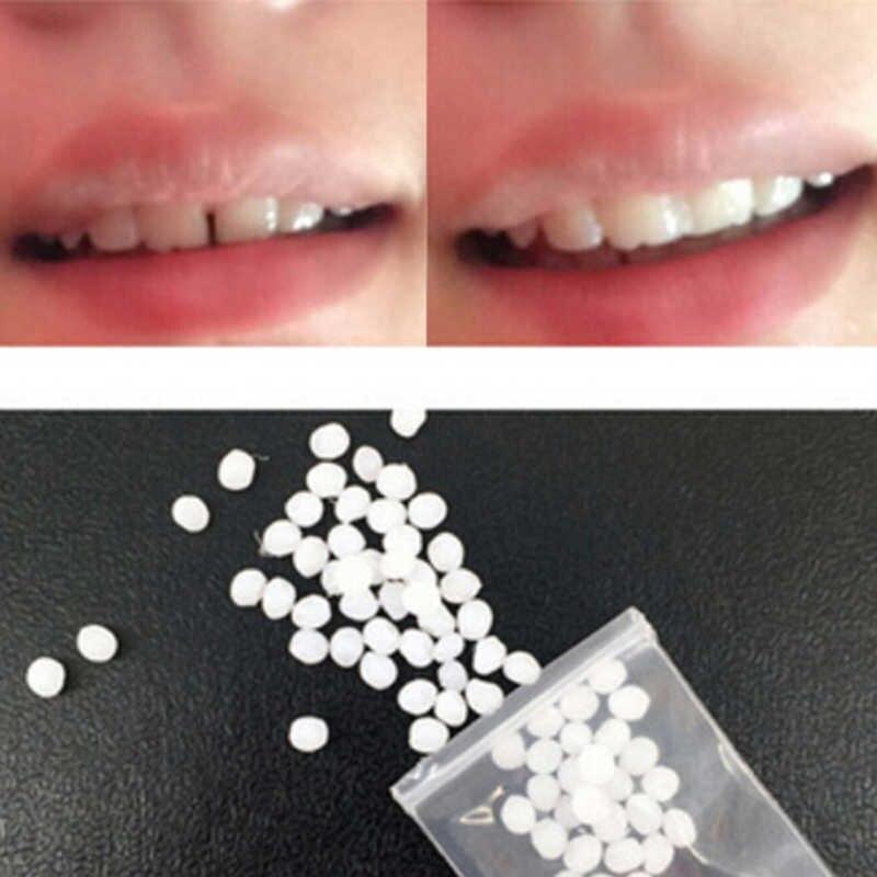 Клей для виниров (временного восстановления зубов) (~3 гр.) - фото 2 - id-p210120798