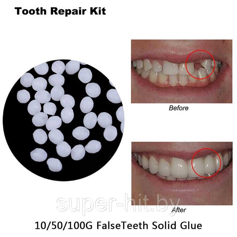 Клей для виниров (временного восстановления зубов) (~3 гр.) - фото 3 - id-p210197651
