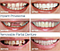 Накладные виниры для зубов Snap-On Smile/Съемные универсальные виниры 2 шт. (верх+низ), фото 7