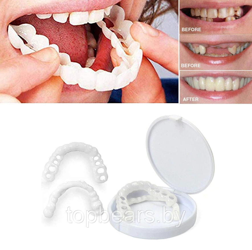 Накладные виниры для зубов Snap-On Smile / Съемные универсальные виниры для ослепительной улыбки 2 шт. (на две - фото 6 - id-p207133058