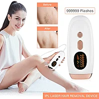 Фотоэпилятор для удаления волос IPL Hair Removal Device (белый)