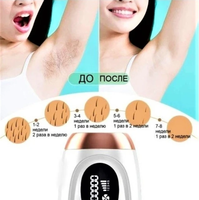 Фотоэпилятор для удаления волос IPL Hair Removal Device (белый) - фото 7 - id-p210922952