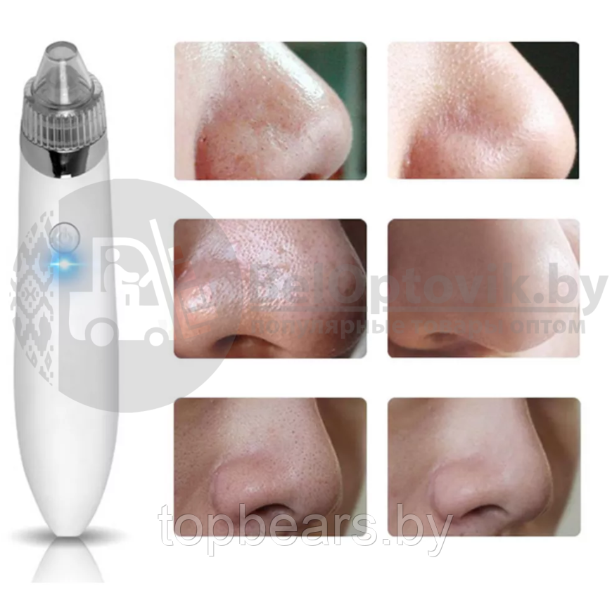 Вакуумный очиститель кожи Beauty Skin Care Specialist XN-8030 Розовый - фото 6 - id-p179744153