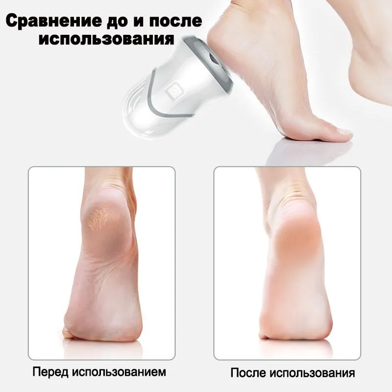 Аппарат по уходу за кожей стоп Wireless Portable Foot Sharpener S161 (2 режима работы, 3 насадки) / Пемза элек - фото 3 - id-p211503989