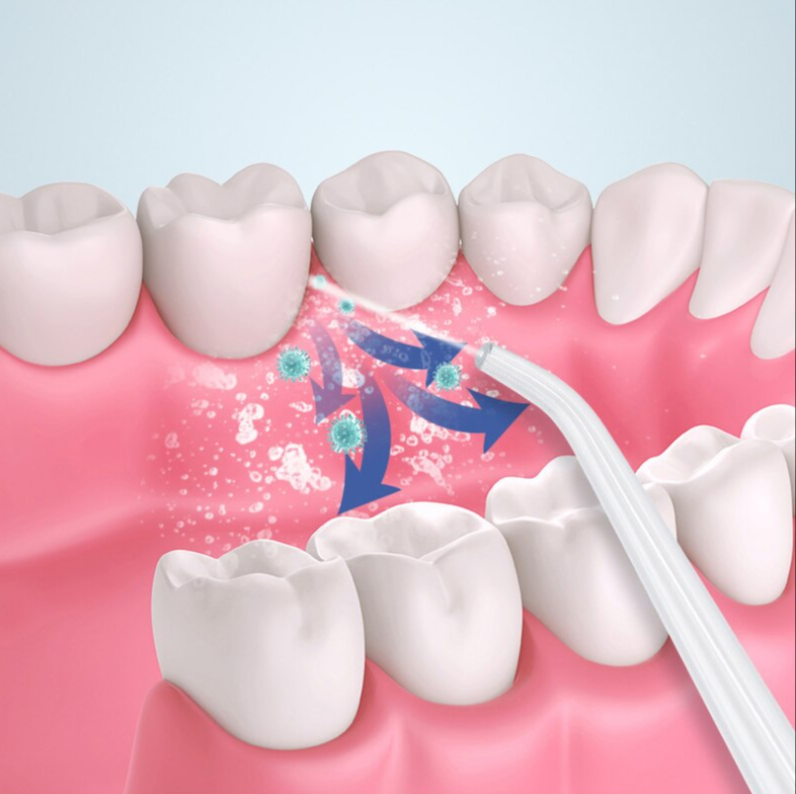 Ирригатор (флоссер) для гигиены полости рта Oral Irrigator 4 сменные насадки Розовый - фото 6 - id-p181587046