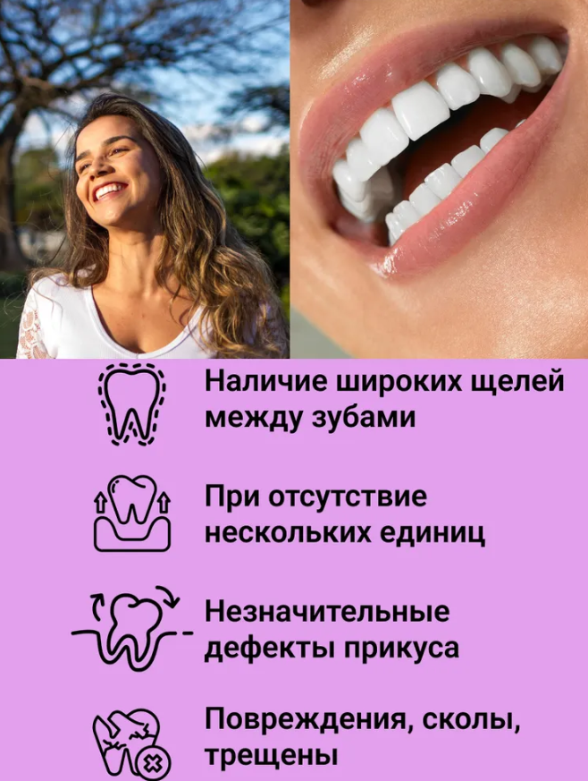 Накладные виниры для зубов Snap-On Smile / Съемные универсальные виниры для ослепительной улыбки 2 шт. (на две - фото 3 - id-p207135000
