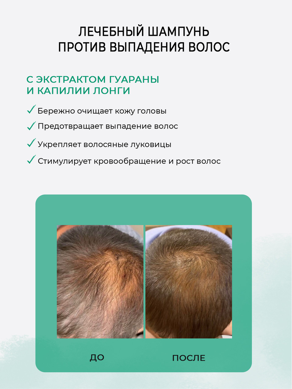 ШАМПУНЬ HAIR LOSS ПРОТИВ ВЫПАДЕНИЯ ВОЛОС (VEGAN), 1000 МЛ. - фото 4 - id-p157307411