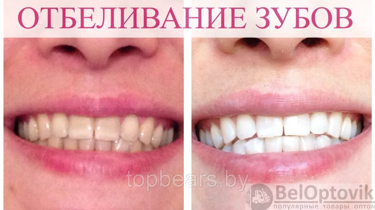 Карандаш для отбеливания зубов Teeth Whitening Pen - фото 5 - id-p214049411