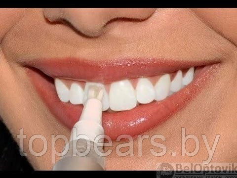 Карандаш для отбеливания зубов Teeth Whitening Pen - фото 1 - id-p214049411