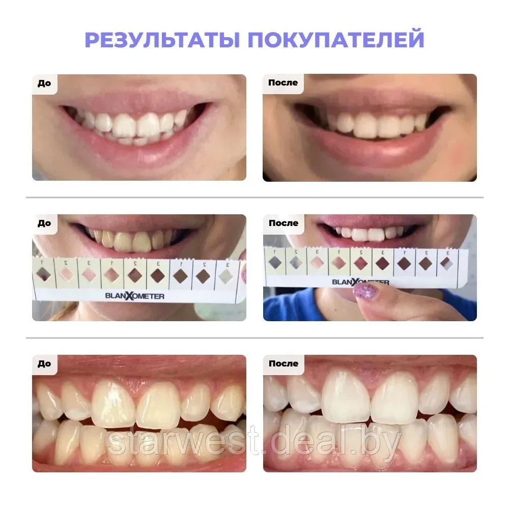 BlanX Healthy Whitening 75 мл Зубная паста отбеливающая для ежедневного применения - фото 6 - id-p215035558