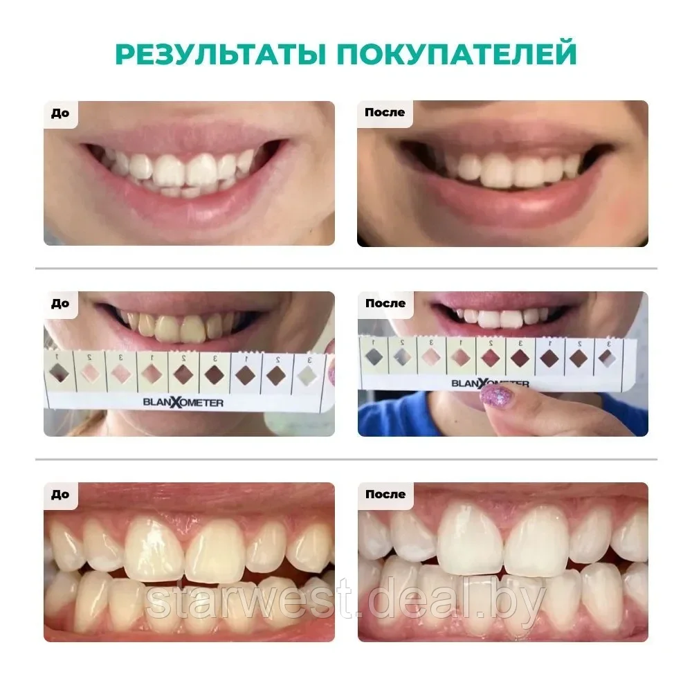 BlanX Intensive Stain Removal Whitening 75 мл Зубная паста отбеливающая для ежедневного применения - фото 6 - id-p215035599