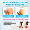 Вакуумный антицеллюлитный массажер для тела Intellegent negative pressure cupping massage instrument, фото 8